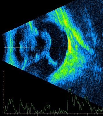 Persistent Hyperplastic Primary Vitreous in animals